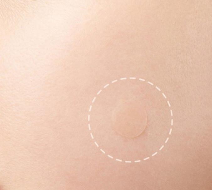 Beauty Acne Patch Set (24 Pcs) Beauty