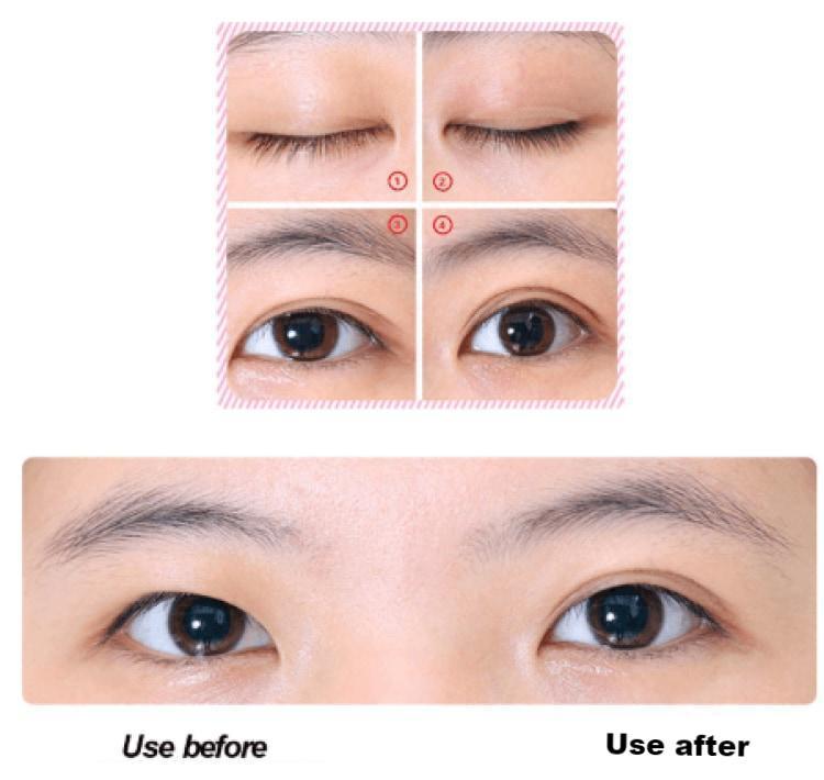 Dream Eyes - Instant Eye Lift