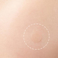 Beauty Acne Patch Set (24 Pcs) Beauty