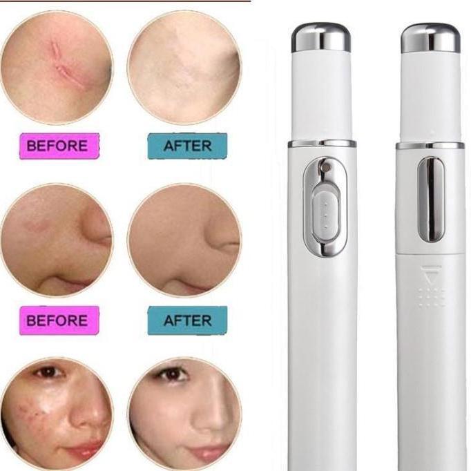 Blue Light Skin Therapy Pen