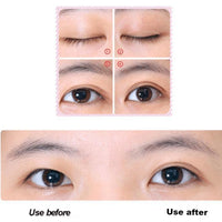 Dream Eyes - Instant Eye Lift